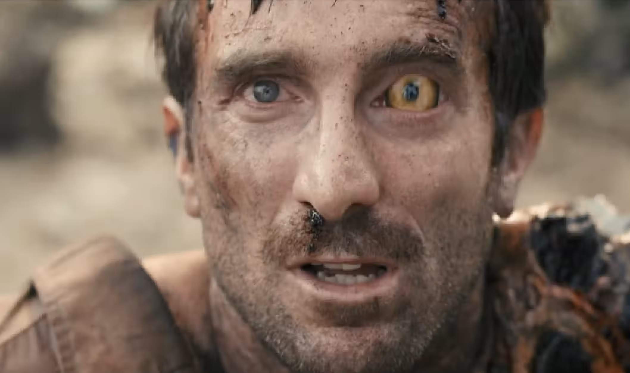 Sharlto Copley district 9