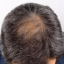 The stigma surrounding male ha...