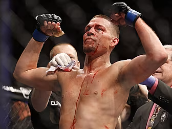 Nate Diaz responds to Conor Mc...