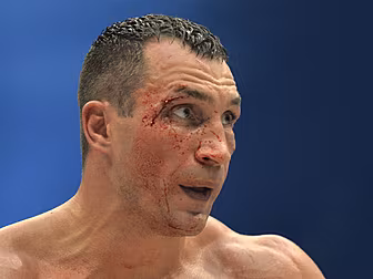 Wladimir Klitschko has sights...