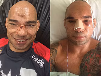 In Pictures: 'Cyborg'...