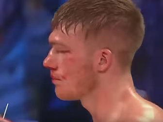 Recently retired boxer Nick Bl...
