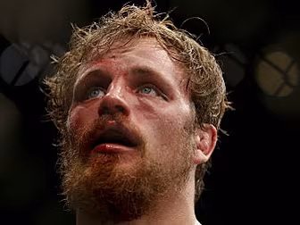 Gunnar Nelson: Weight cutting...