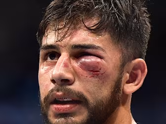 Yair Rodriguez taking the posi...