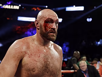 Andy Lee on Tyson Fury's cut |...