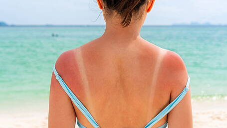 Sunscreen still taxed as a ‘luxury product’ as dispensers called for Image