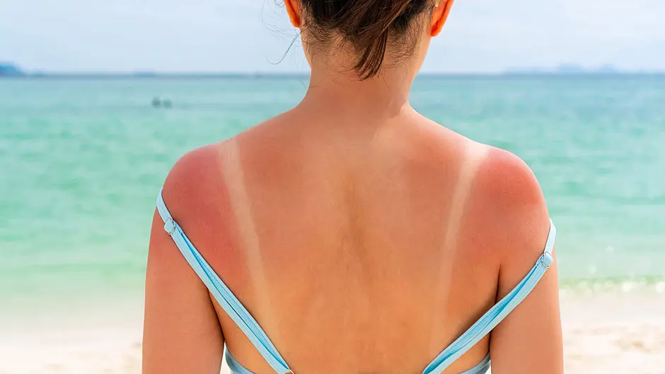 Sunscreen still taxed as a ‘luxury product’ as dispensers called for Image