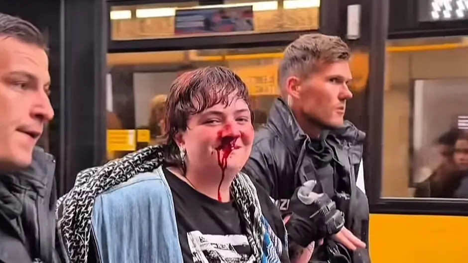 Assaulted protester Kitty vows a return to demos Image