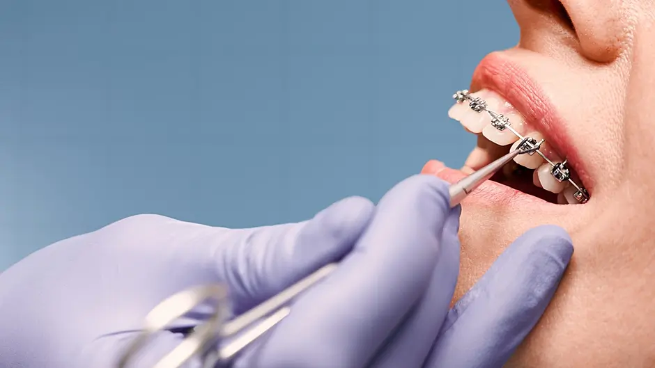 Teen waits 11 years for dental treatment in West Cork Image