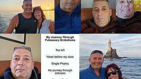 Garry Minihane feels glad to be alive after blood clot shock Image