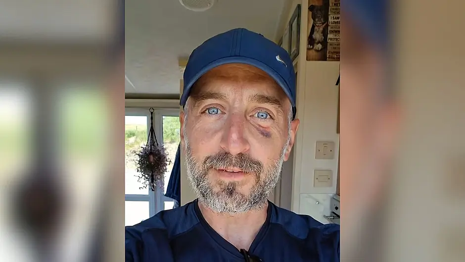 Flotilla activist outlines being ‘punched and hit with a rifle’ Image
