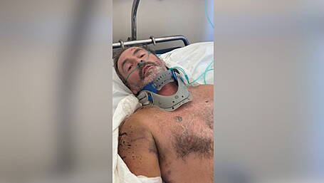 Over €65,000 donated to fund for injured Ballineen man stuck in hospital in Greece Image