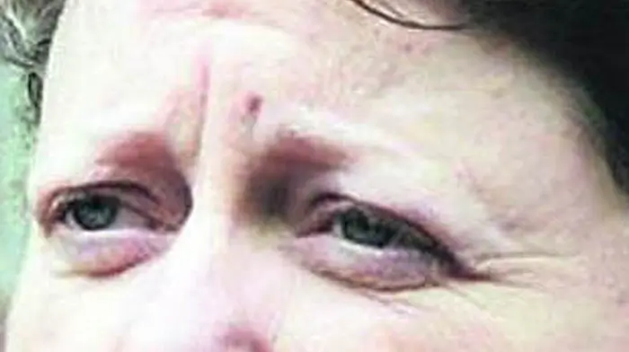 Airbnb may be used for victims of domestic abuse Image
