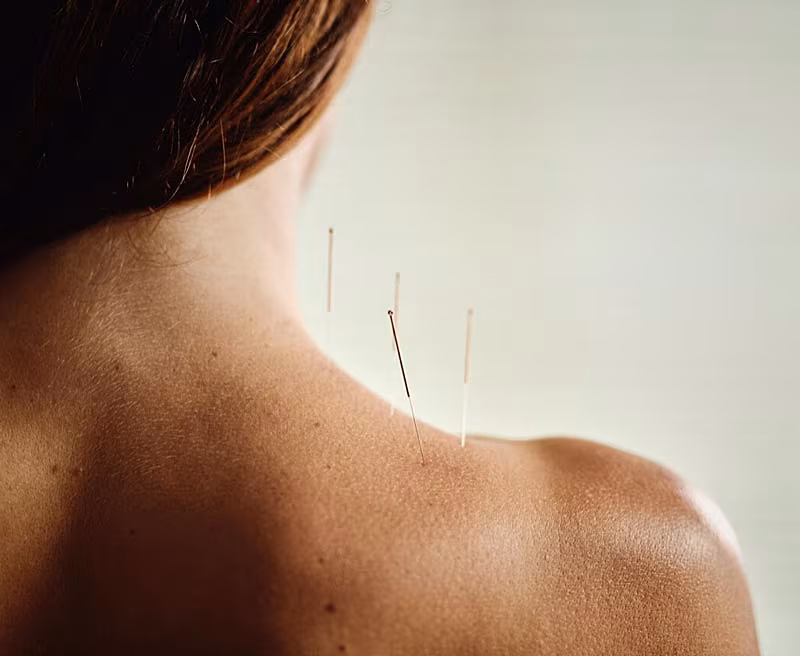 Escapada+Health+-+Natural+Treatment+&+Acupuncture