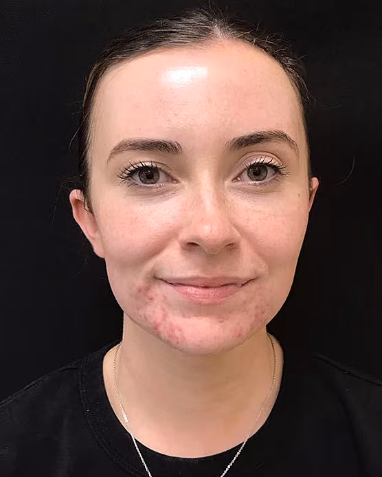 Beacon Face and Dermatology 2