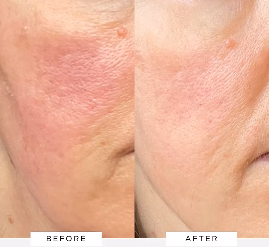 Flawless Brightly Serum