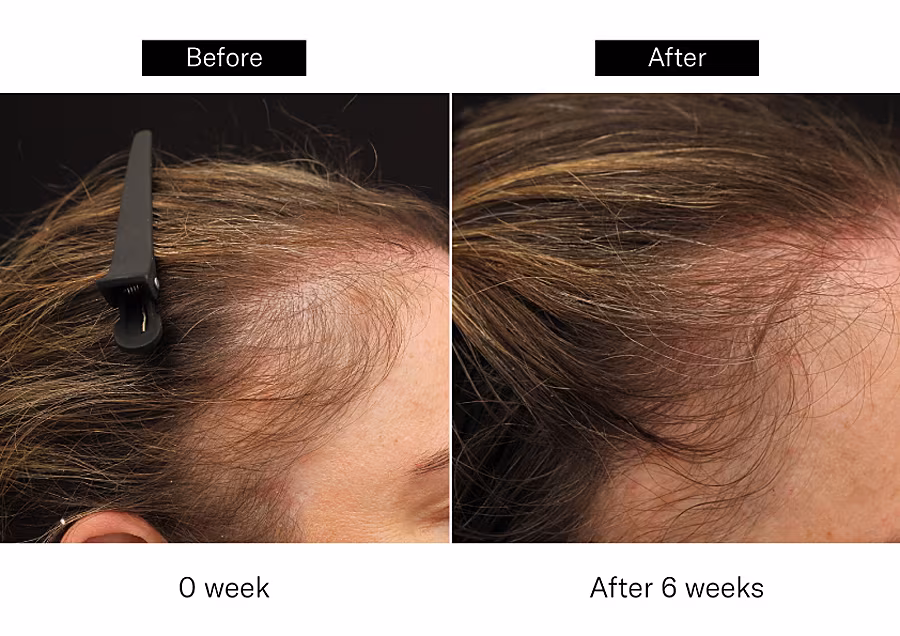 Before-and-After_Manav-Bawa-01