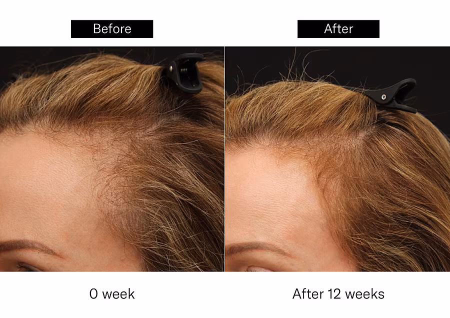 Before-and-After_Manav-Bawa-02