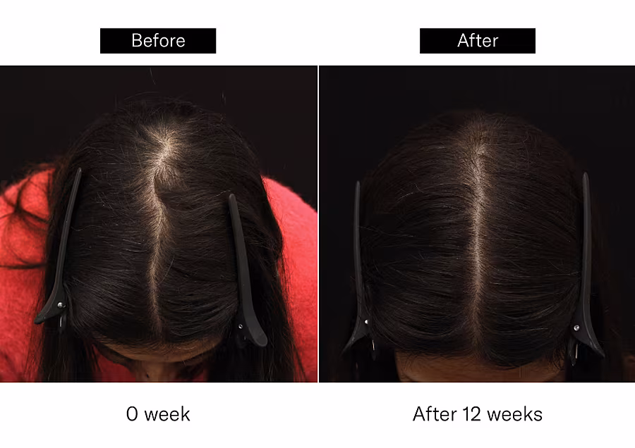 Before-and-After_Manav-Bawa-03