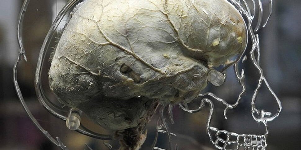 Scientists grow human brain