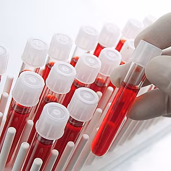 A New Blood Test to Determine...