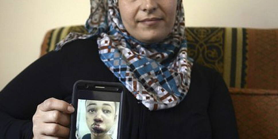 US concern after teen beaten i...