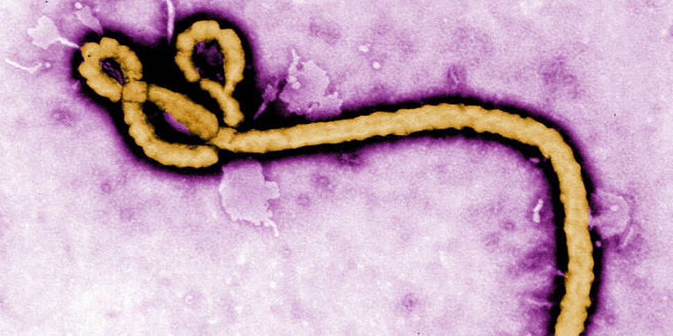 17 Ebola Patients Missing Afte...