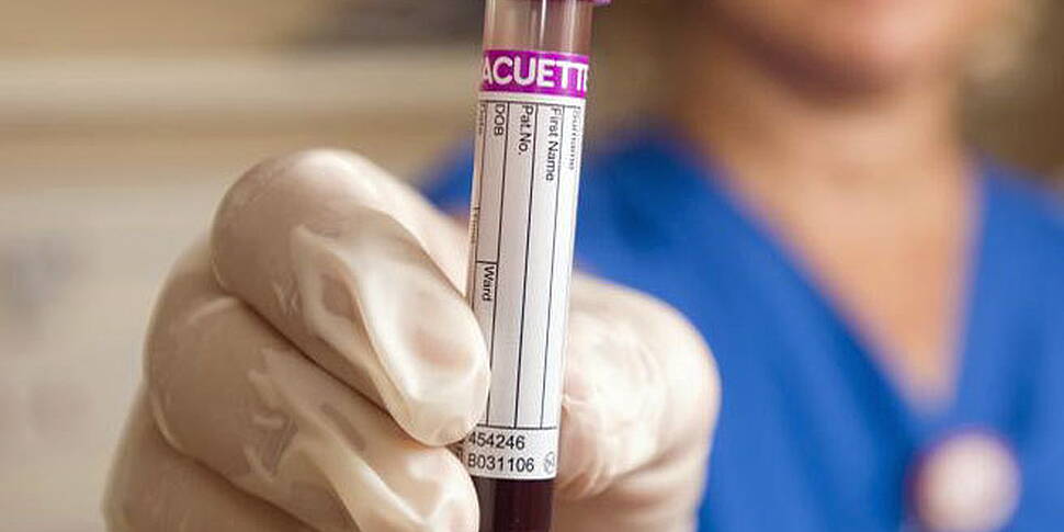 Irish cancer survival rates am...
