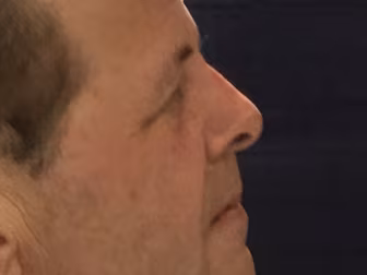 #SideProfileSelfie Campaign Go...