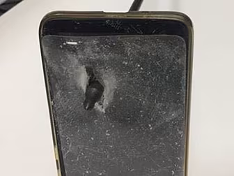 A Man Saved His Own Life By Bl...