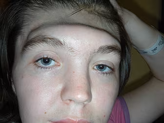 Brain Injury Victim Makes Appe...