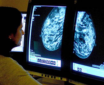 Up To 2,000 Cancers 'Lost' As...