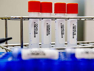 Coronavirus: 562 New Cases Con...
