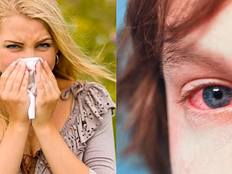 How To Beat Hay Fever This Sum...