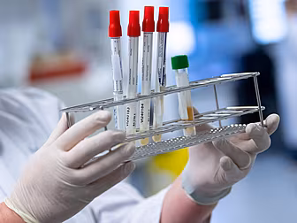 Coronavirus: 288 New Cases Con...