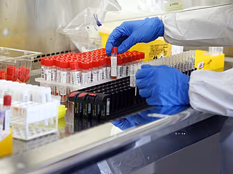 Coronavirus: 431 New Cases Con...