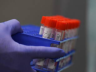 Coronavirus: 1,126 New Cases R...