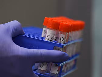 Coronavirus: 1,126 New Cases R...
