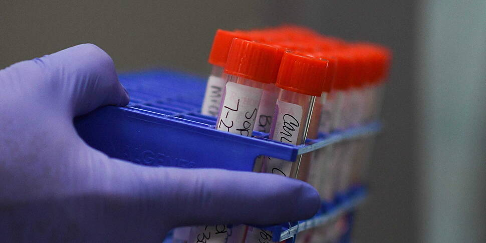 Coronavirus: 315 New Cases Con...