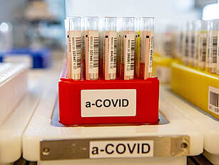 Coronavirus: 581 New Cases Con...