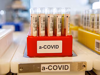 Coronavirus: 581 New Cases Con...