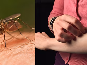 Here's Why Mozzie's Have Us Al...