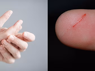 Why Do Papercuts Hurt So Badly...