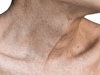 How To Protect Aging Skin