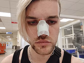 Man Assaulted In Suspected Hom...